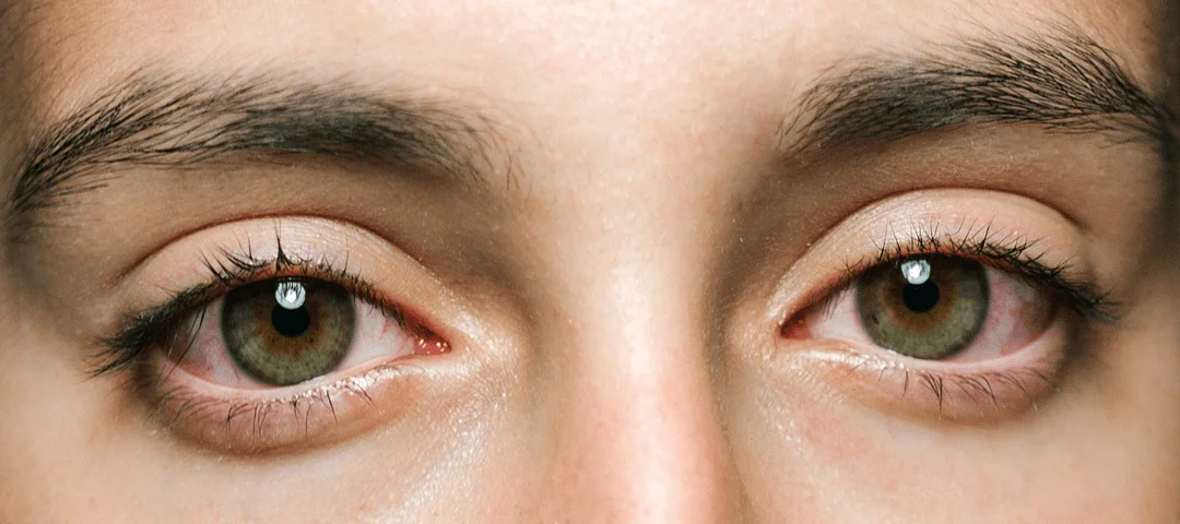 Ojos cansados por la mañana